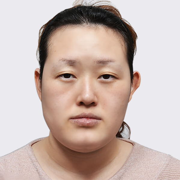 https://beauty.findclinic.kr/wp-content/uploads/sites/14/2020/06/skin-before01.jpg