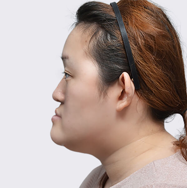 https://beauty.findclinic.kr/wp-content/uploads/sites/14/2020/06/skin-before03.jpg
