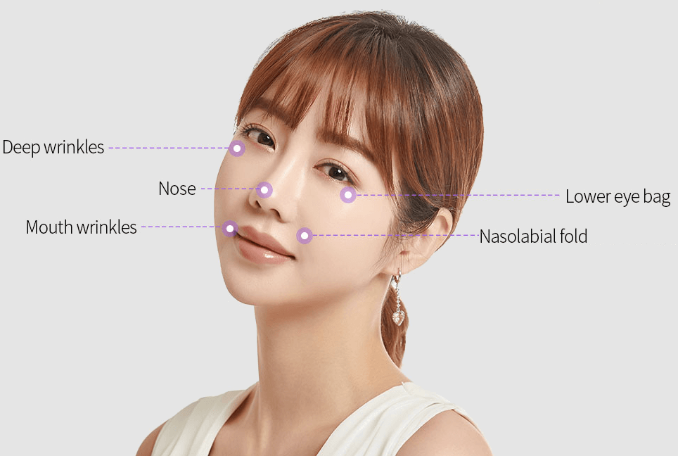 https://beauty.findclinic.kr/wp-content/uploads/sites/14/2020/07/areas-filler.png